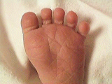 安静時の赤ちゃんの足。   紅葉の様に指が開いてい  ます。 